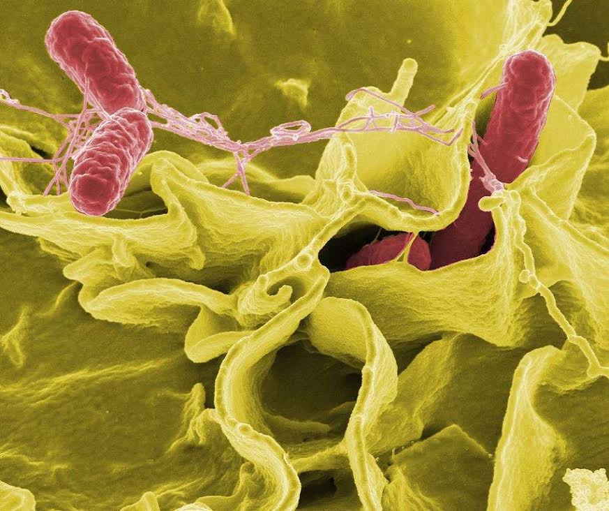 18 10 06 OP Las superbacterias más peligrosas del mundo 2