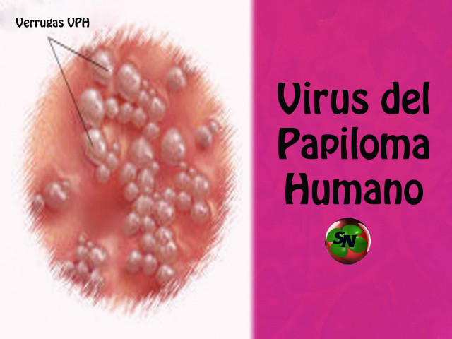 19 11 01 OP Los EEUU refuerzan sus campañas de vacunación contra el virus del papiloma humano 3