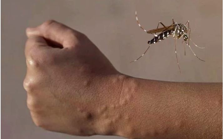 20 04 15 OP COVID19 El peligro de los hábitos de las sociedades modernas 2 Dengue enfermedad trasmitida por el mosquito Aedes aegypti