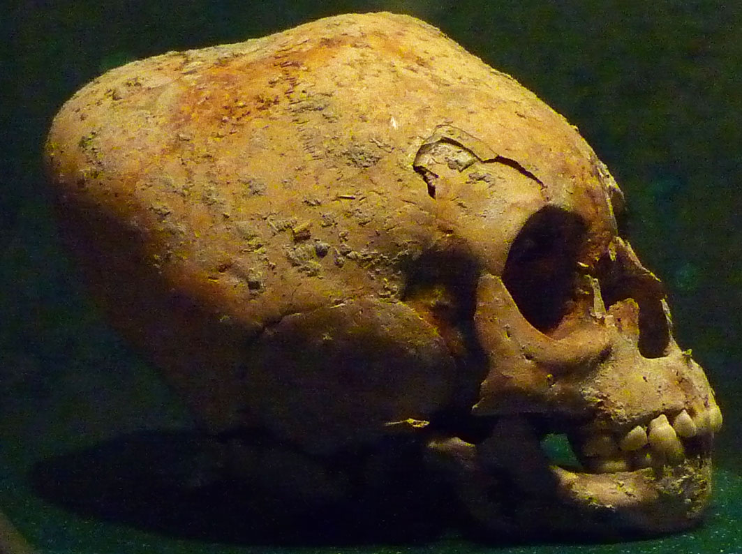 21 10 08 PGD Bonampak la cacería humana 1 Cráneo Maya